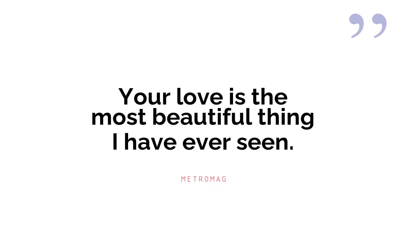 Your love is the most beautiful thing I have ever seen.