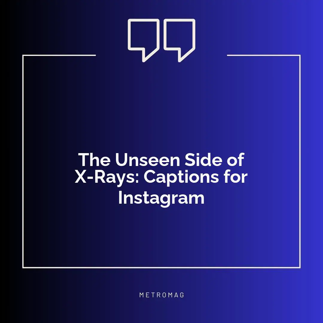 The Unseen Side of X-Rays: Captions for Instagram