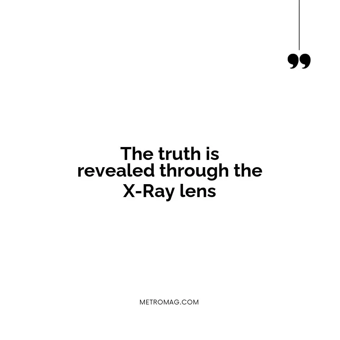 The truth is revealed through the X-Ray lens