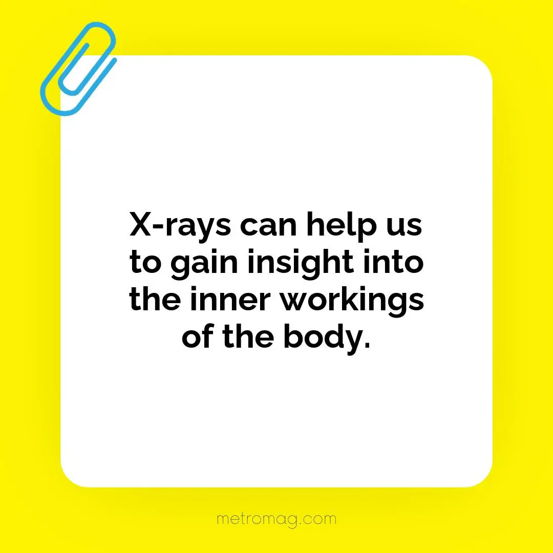 X-rays can help us to gain insight into the inner workings of the body.