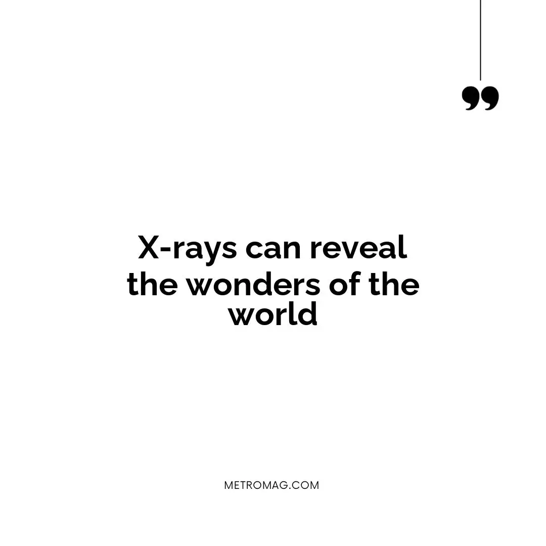 X-rays can reveal the wonders of the world