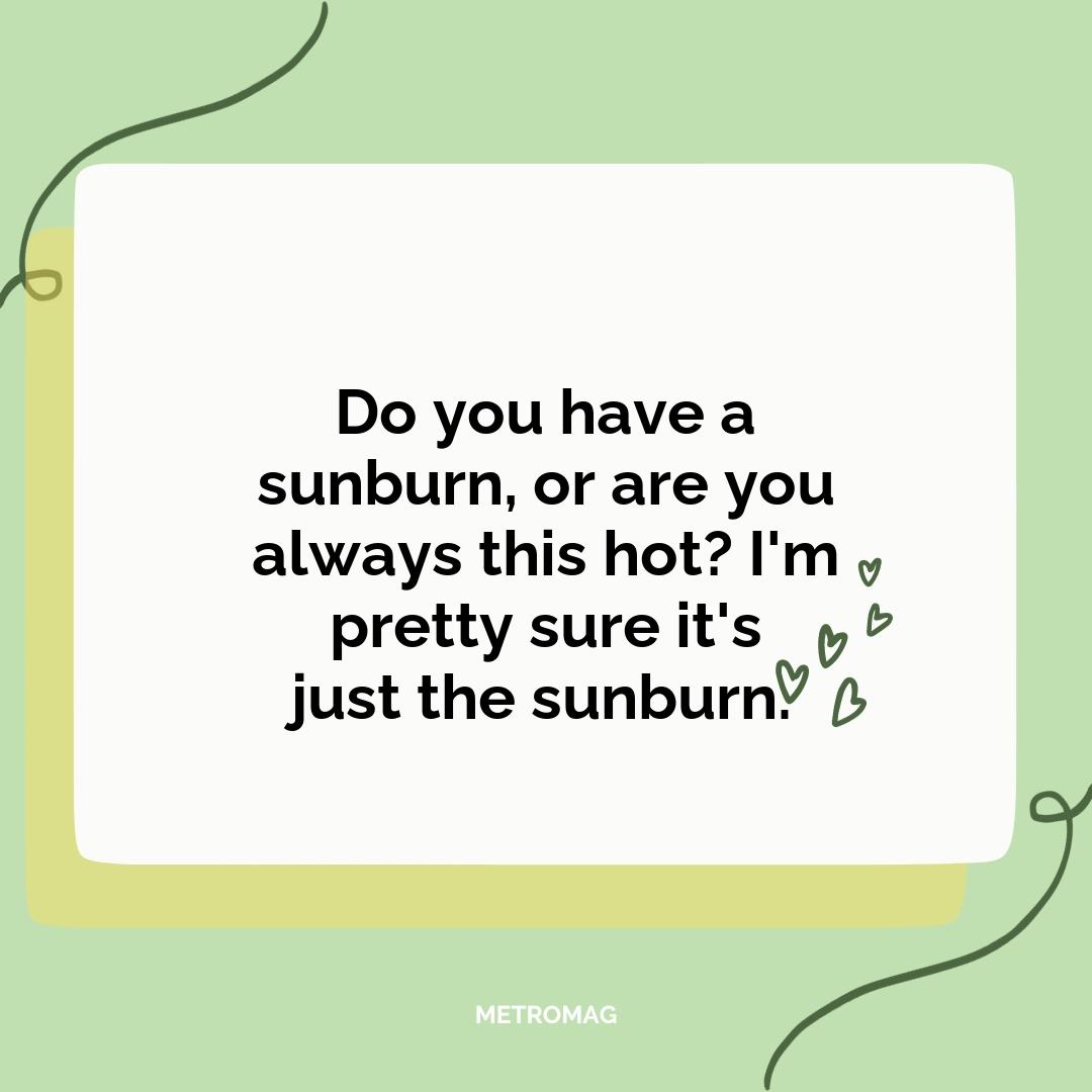 Do you have a sunburn, or are you always this hot? I'm pretty sure it's just the sunburn.