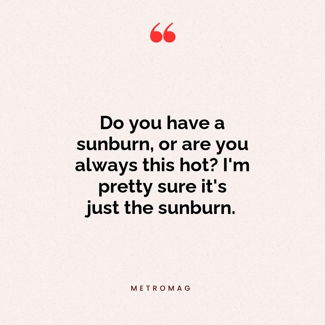 Do you have a sunburn, or are you always this hot? I'm pretty sure it's just the sunburn.