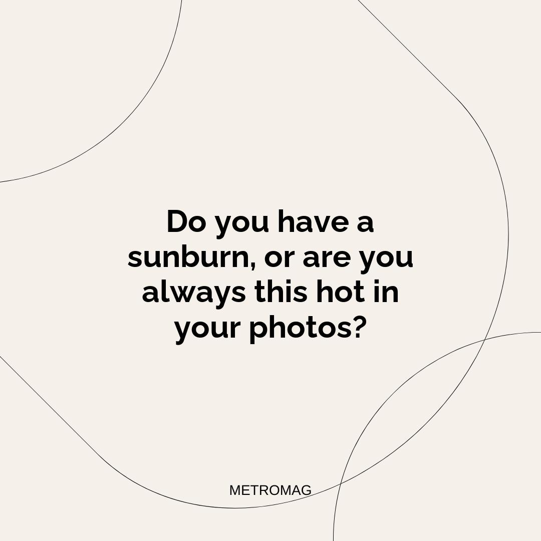 Do you have a sunburn, or are you always this hot in your photos?